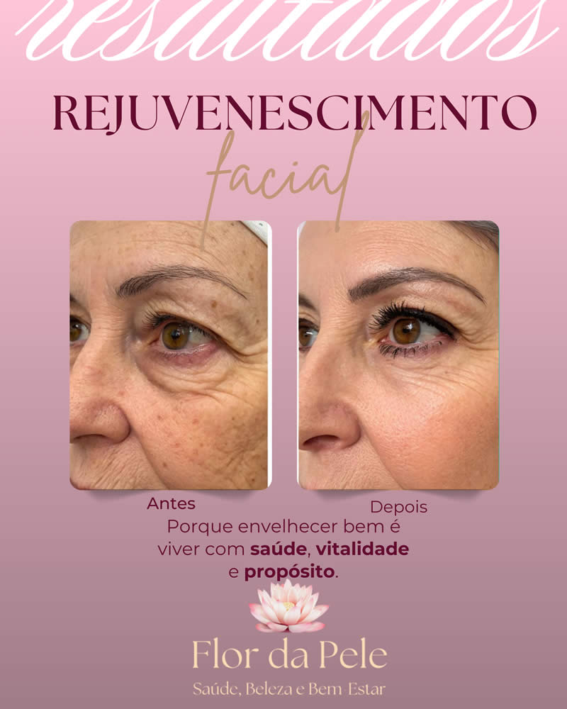 Copia-de-Rejuvenescimento_20250905_121246_0000.jpg